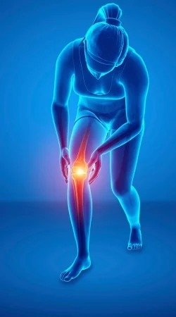 Lesiones de Rodilla