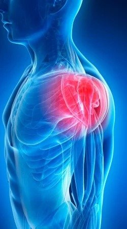 Lesiones de Hombro y Codo