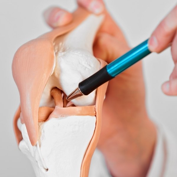 Reconstrucción de Ligamento Cruzado Anterior en Santa Cruz